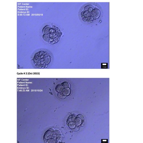IVF - Effect of TCM treatment on embryo quality in 5 months copy