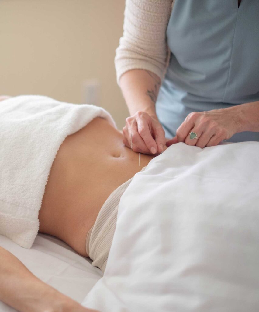 Woman getting acupuncture in belly | Traditional Chinese-Style Acupuncture Services | Boulder & Longmont