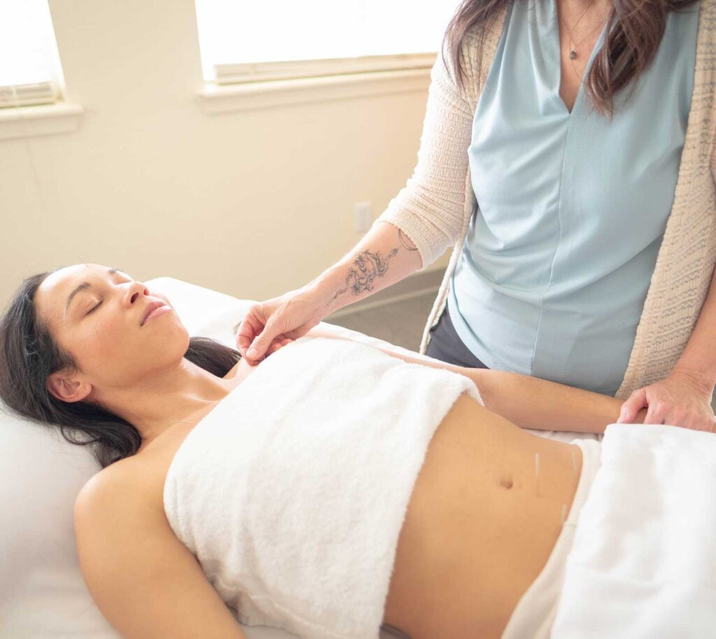 Woman lying on table getting Acupuncture for Insomnia | Well Woman Acupuncture Boulder