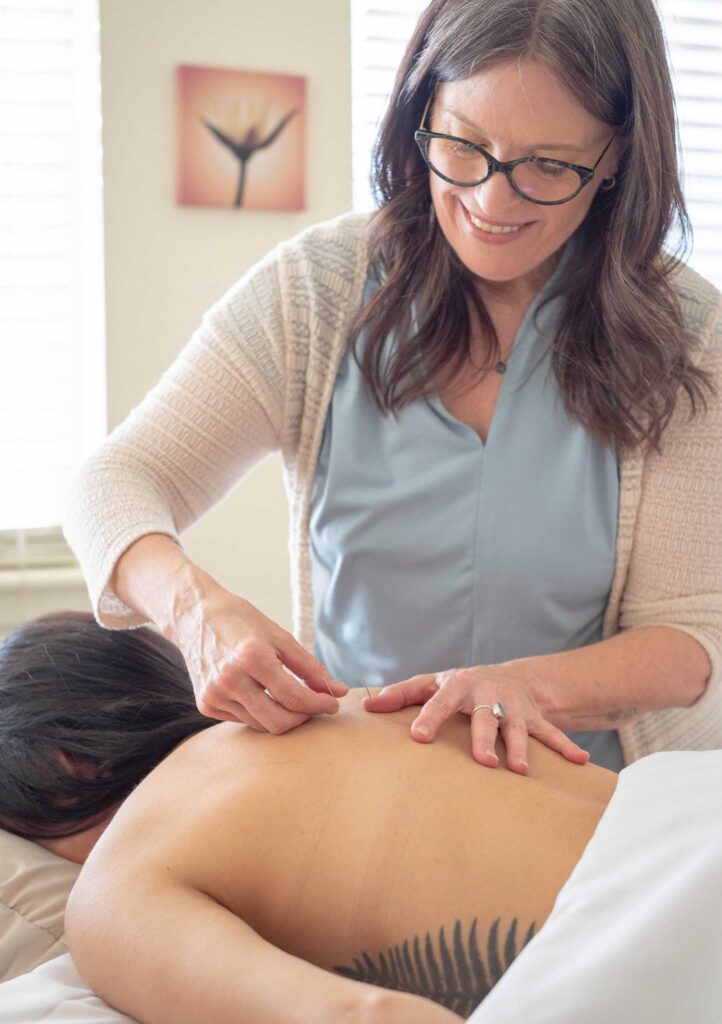 Acupuncture in back | Traditional Chinese-Style Acupuncture Services | Boulder & Longmont