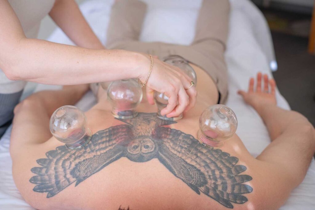 Cupping on a woman with an owl tattoo | Traditional Chinese-Style Acupuncture Services | Boulder & Longmont