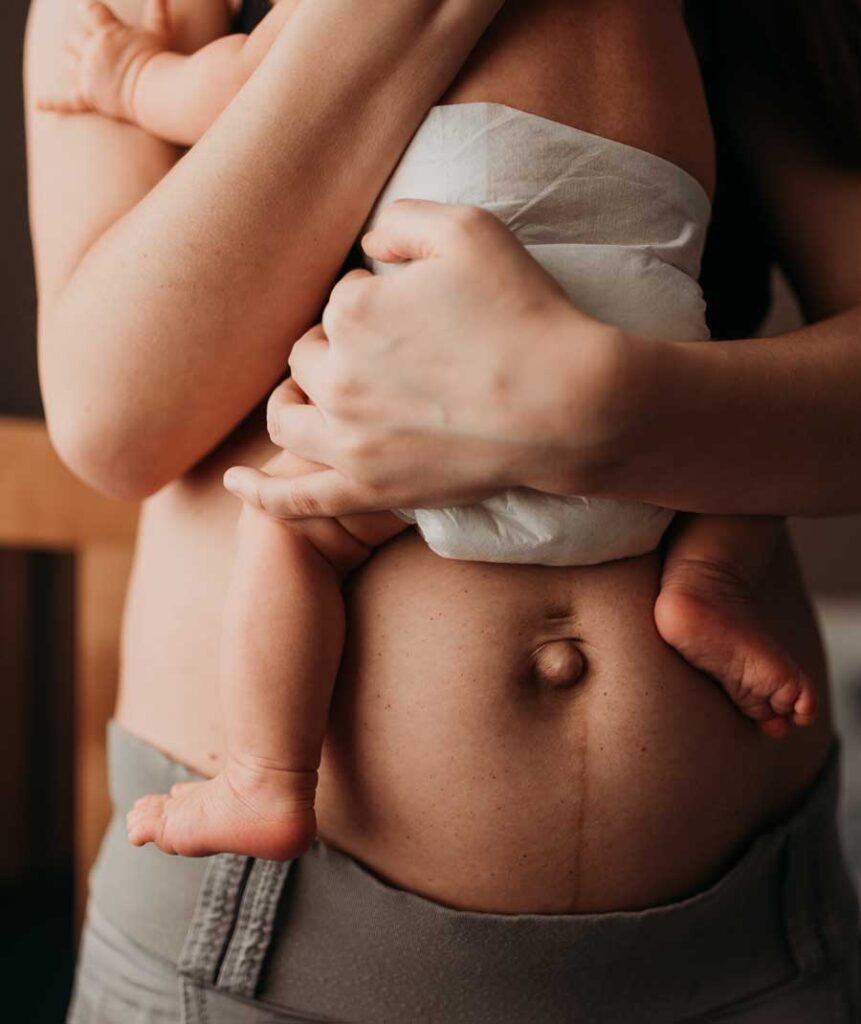 New mother holding newborn child showing her belly | Acupuncture for Pregnancy & Postpartum in Boulder & Longmont