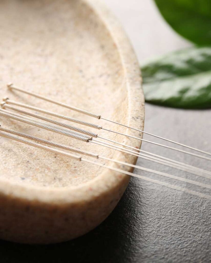 Acupuncture needles laying in a bowl | Traditional Chinese-Style Acupuncture Services | Boulder & Longmont