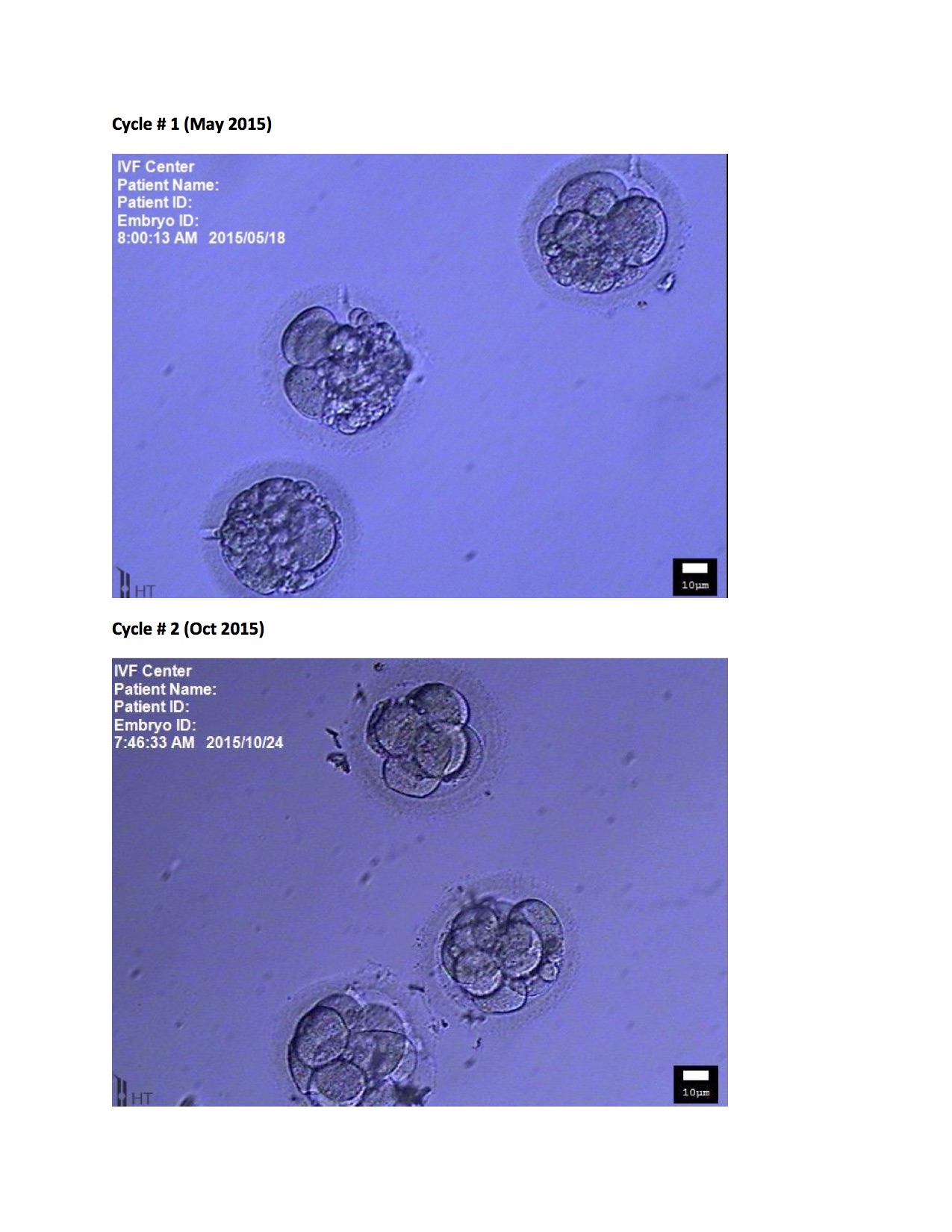 IVF - Effect of TCM treatment on embryo quality in 5 months copy